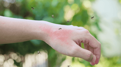 הדברת יתושים בבית / בגינה | המדריך עבור הדברה יעילה של יתושים