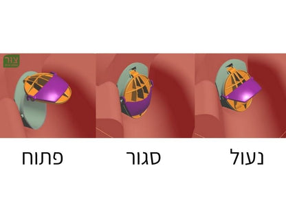 מתקן שסתום המונע כניסת חולדות ועכברים דרך מערכת הביוב וחדירת נוזלים אל תוך הבית, מיוצר בבריטניה, 4'' (צול)